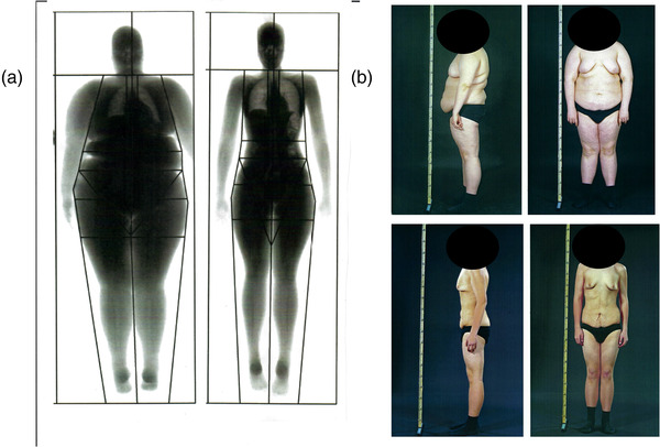 Fig. 3