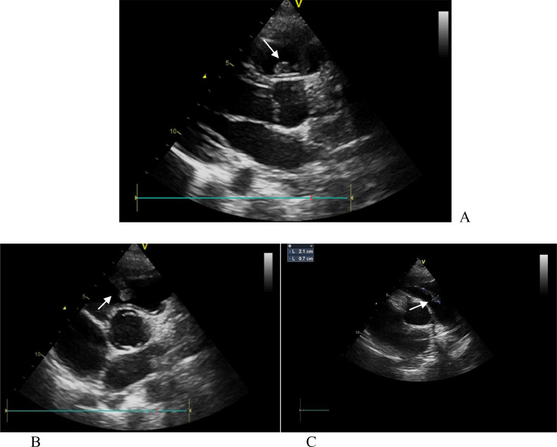 Fig. 3.