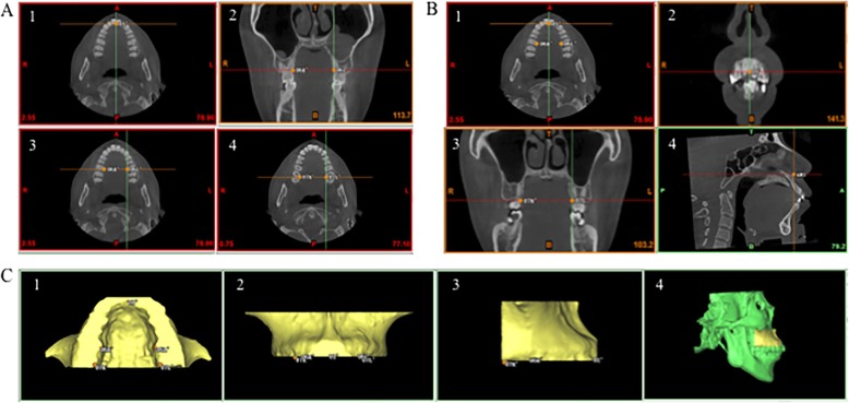 Fig. 2