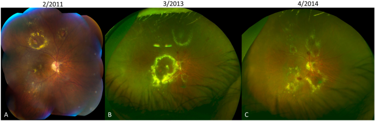 Fig. 1