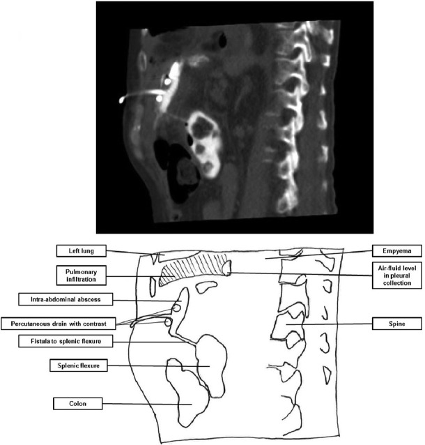 Figure 1