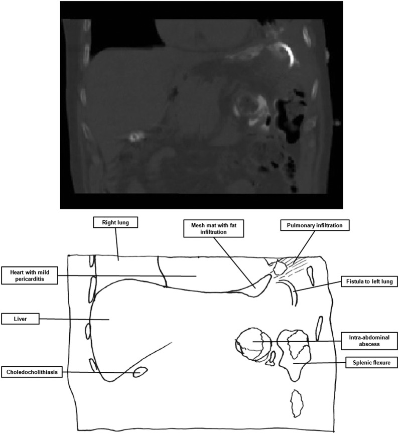 Figure 2