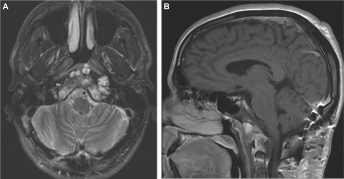 FIGURE 11.