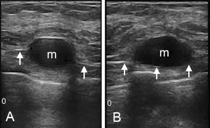 Figure 2, A&B