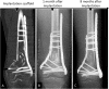 Fig. 3