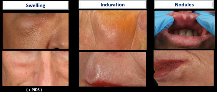 Figure 30