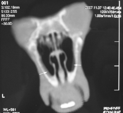 Fig. 2