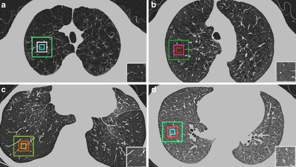 Fig 1