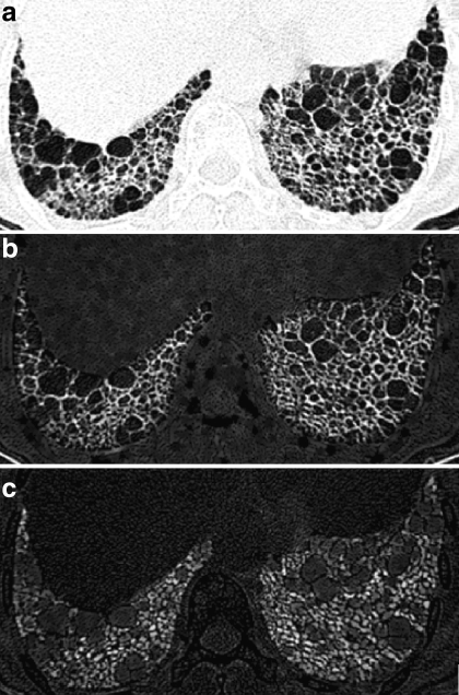 Fig 2