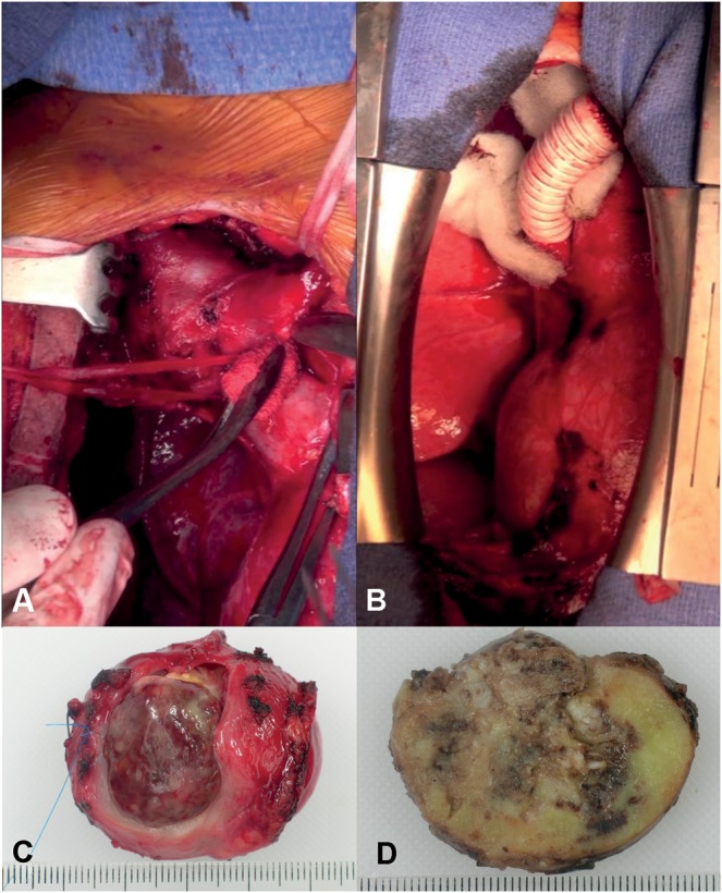 Figure 2: