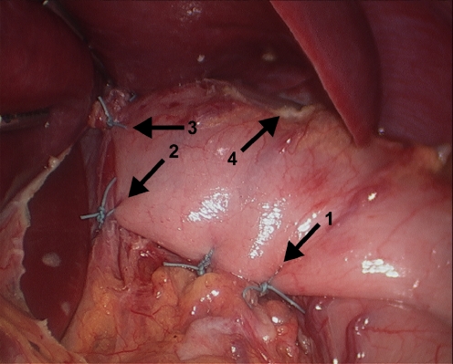 Figure 7