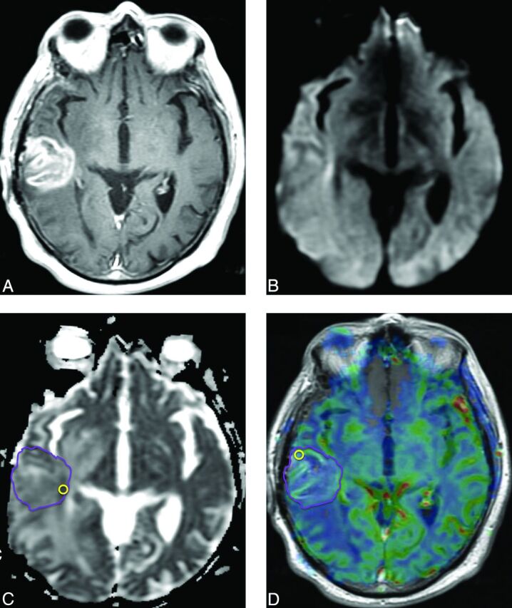 Fig 6.