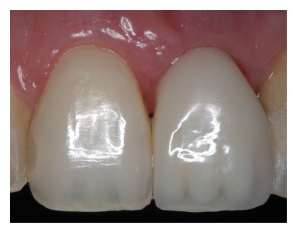 Figure 10