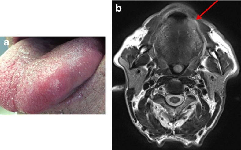 Fig. 1