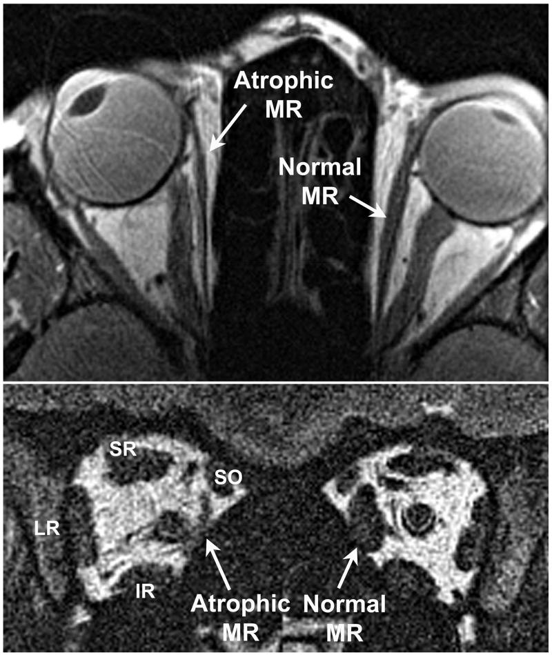 FIG 3