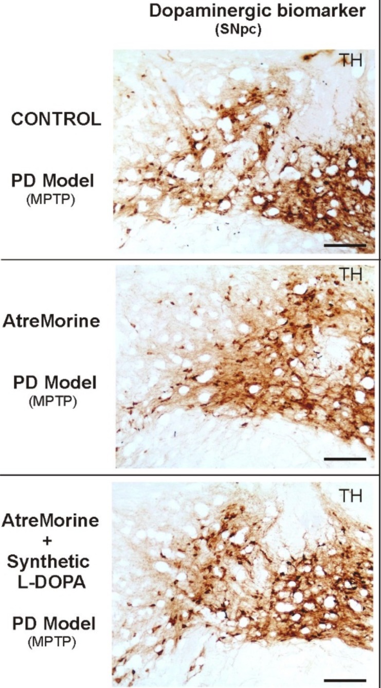 Fig. (1)