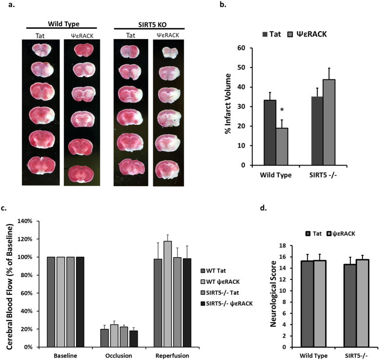 Protein Kinase C Epsilon Promotes Cerebral Ischemic Tolerance Via ...