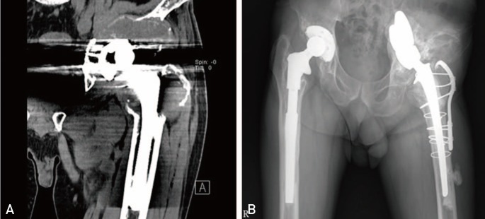 Fig. 11