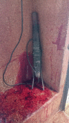 Fig 4
