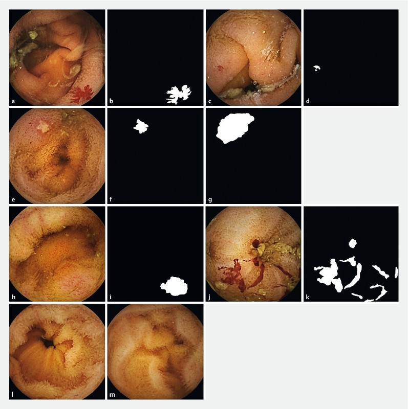 Fig. 1