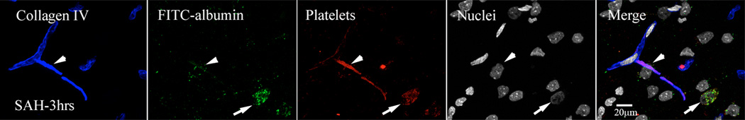 Figure-4