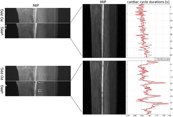 Fig. 12