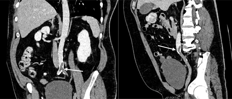 Fig 1