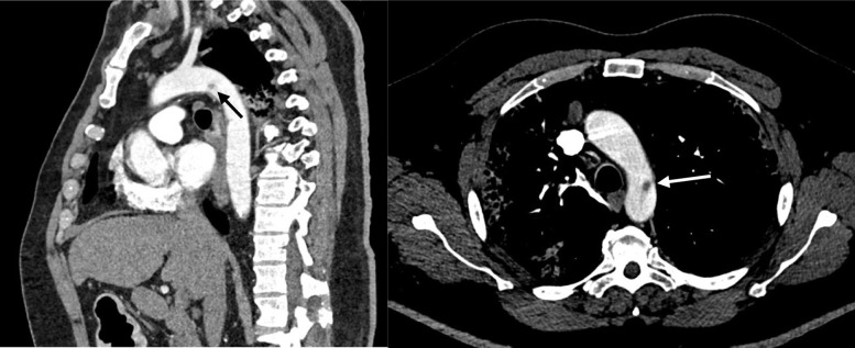 Fig 2