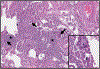 Fig. 11