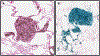 Fig. 12