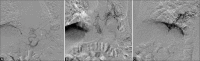 Figure 2 (A-C)