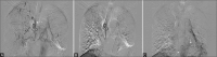 Figure 1 (A-C)