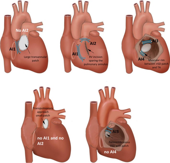 Figure 12