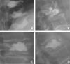 Fig. 4