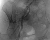 Figure 2a