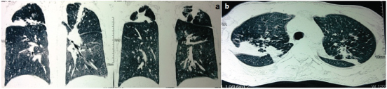 [Table/Fig-3a,b]: