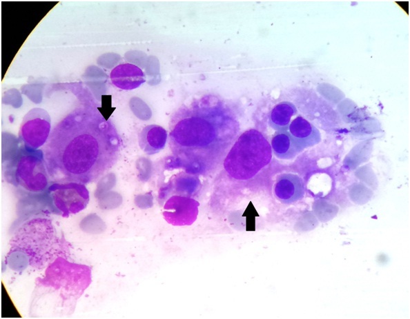 [Table/Fig-5]: