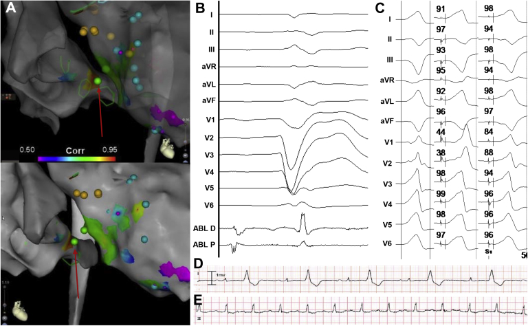 Figure 1