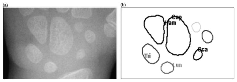 Fig. 12