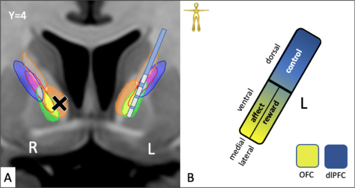 Fig. 13