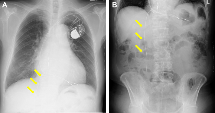 Figure 3