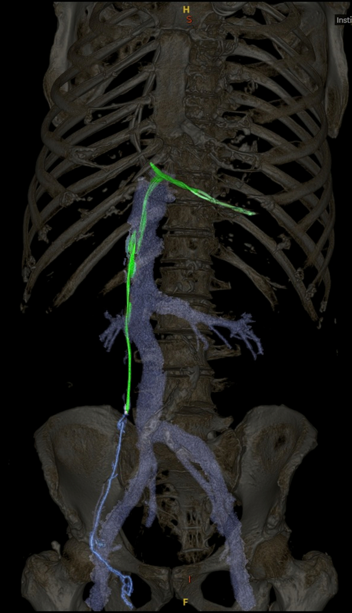 Figure 4