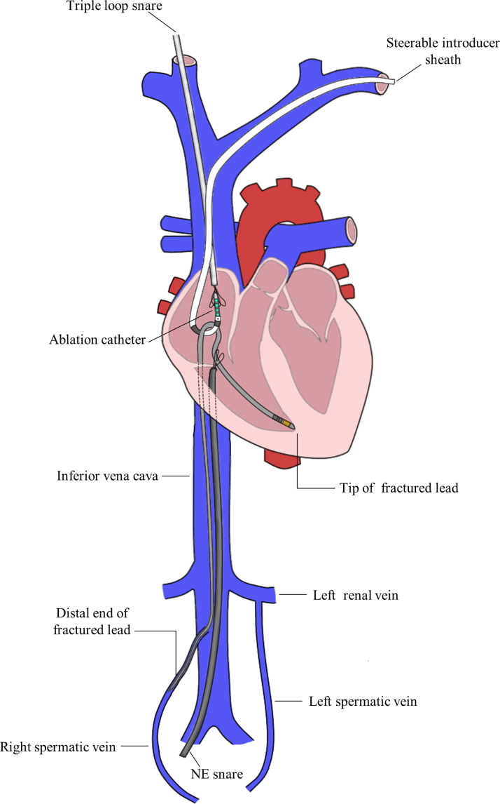 Figure 5