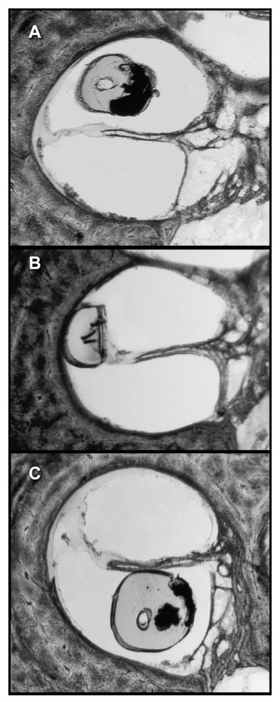 FIG. 5