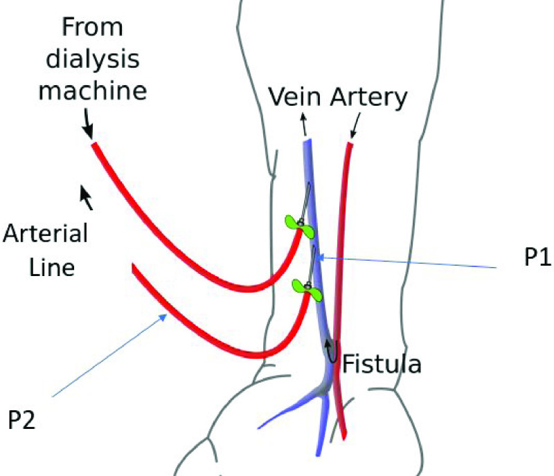 FIGURE 4.