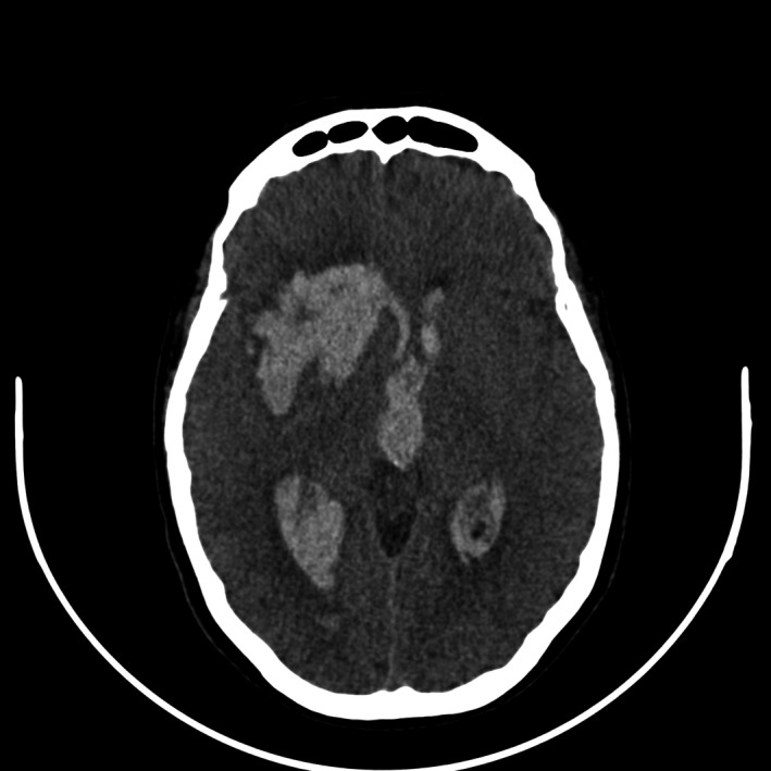 FIGURE 1