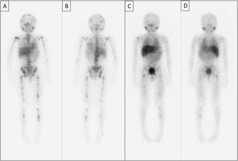 Fig. 12