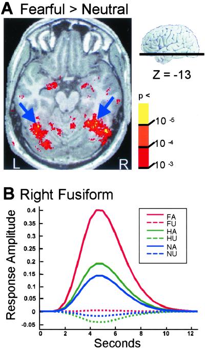 Fig 3.