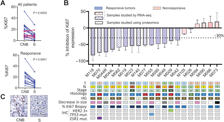 Figure 2. Primary endpoint: Ki67 expression. A, Ki67 expression before (CNB) and after (S) mifepristone treatment. Top, all samples were included (n = 20), except sample M124. The differences in Ki67 values were studied using the Wilcoxon matched pairs signed-rank test. The pairing was significant (P = 0.0004); rs Spearman: 0.6932. Bottom, only responsive cases were included (n = 14). The pairing was significant (P = 0.0001); rs Spearman: 0.8637. B, Top, waterfall plot showing the percentage of inhibition in each individual patient. Negative values below 30% indicate inhibitory effects. The samples that were chosen for RNA-seq studies are denoted in the graph using a different fill texture, and those used in proteomics with a thicker column frame. Bottom: squares represent different parameters such as tumor size (T1-4), lymphatic nodes (N0-3), tumor stage (1–3), histologic type (D: IC-NST, L: ILC, P: papillary, and M: mucinous), histologic grade (2 and 3), HER2 expression (green box), p53 mutation (blue box), and ESR1 missense mutation (RNA-seq data; violet box). Decreases in tumor size higher than 20% in ultrasound studies are shown in pink squares, in dark gray those not determined, in white: not considered because different operators performed the studies, light gray: no change and black, increase in size. The Ki67 values in CNB < 10% are shown in light blue, 10%–20% in blue and >20% in dark blue. C, Representative IHC of Ki67 staining (patient M055). Bar: 100 μmol/L.