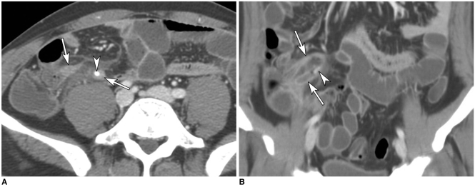 Fig. 5